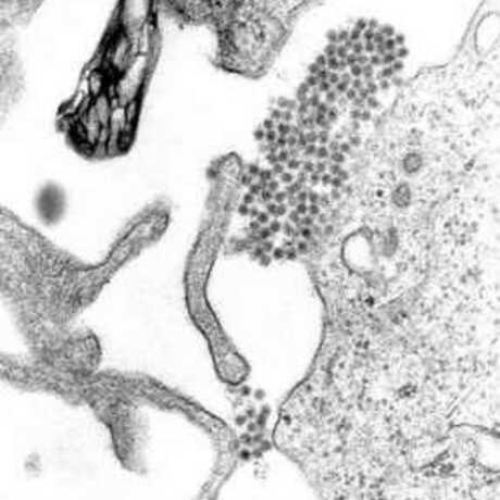 Denge virus under a microscope