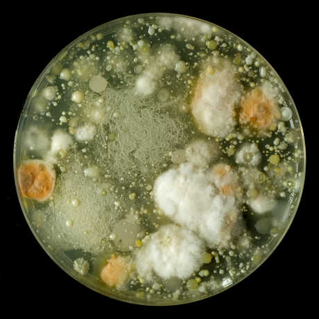 Bacteria in a petri dish