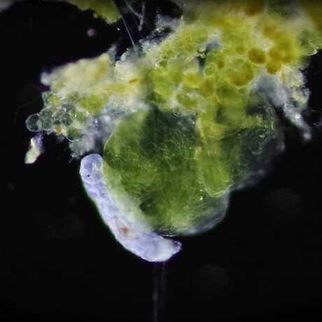 Tardigrade and Cyanobacteria - Antarctic microscopy